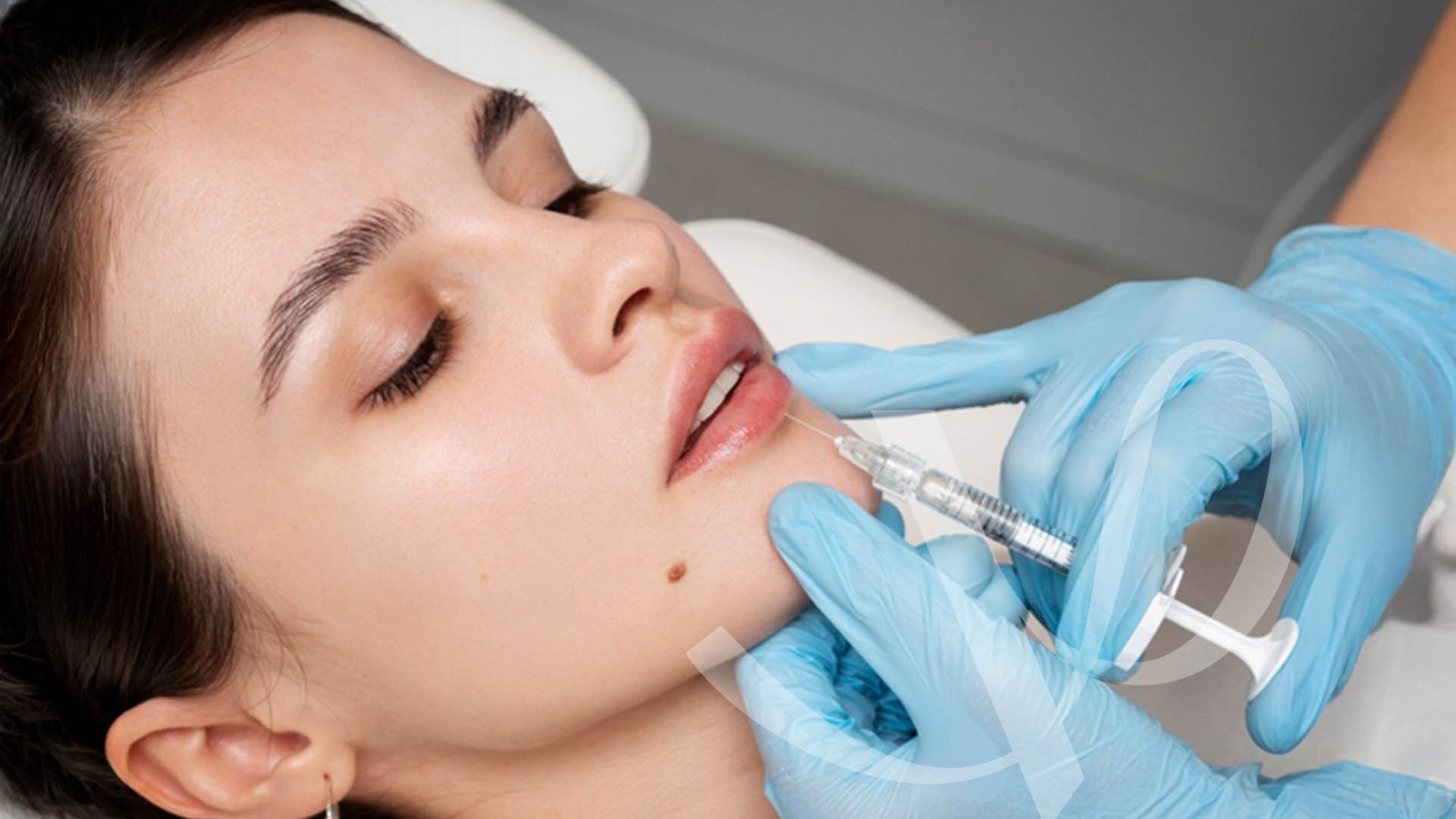 Victoria Medicina Estética - Relleno de Labios en Córdoba con Ácido Hialurónico